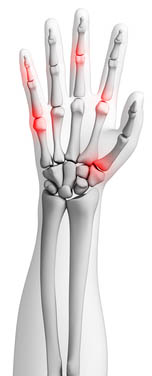 Maintaining health and fitness when working with horses - joint problems